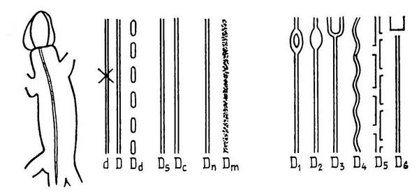 Фены рисунка спины прыткой ящерицы, центральная дорсомедиальная полоса. По Пикулику (1988),